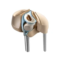 Reemplazo de rodilla por artritis